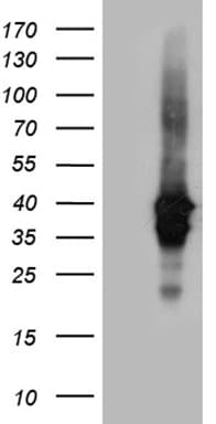 UPRT Antibody (clone OTI1D11, Carrier-free)