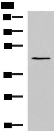 KCNK18 / TRESK Antibody