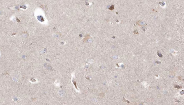 CYP26B1 Antibody