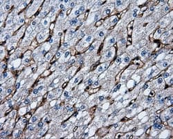 CD36 Antibody (clone OTI3F4)