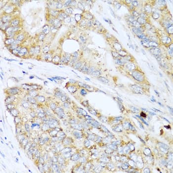 LYZ / Lysozyme Antibody