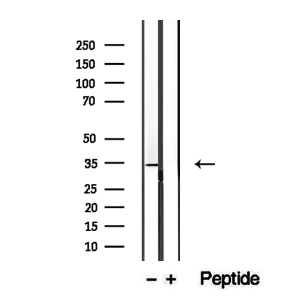 WBP2NL Antibody