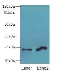 Polyclonal Rabbit anti-Human MRAP2 Antibody (WB)