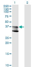 SMPD1 / Acid Sphingomyelinase Antibody (clone 4H2)