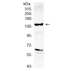 Polyclonal Rabbit anti-Human ERBB2 / HER2 Antibody (IHC, WB)
