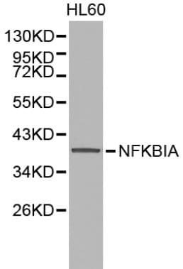 NFKBIA / IKB Alpha / IKBA Antibody
