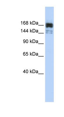 XRN1 Antibody (aa1260-1309)