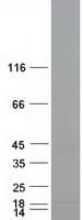 Human RNASE4 Protein (Recombinant Myc-DDK (Flag))
