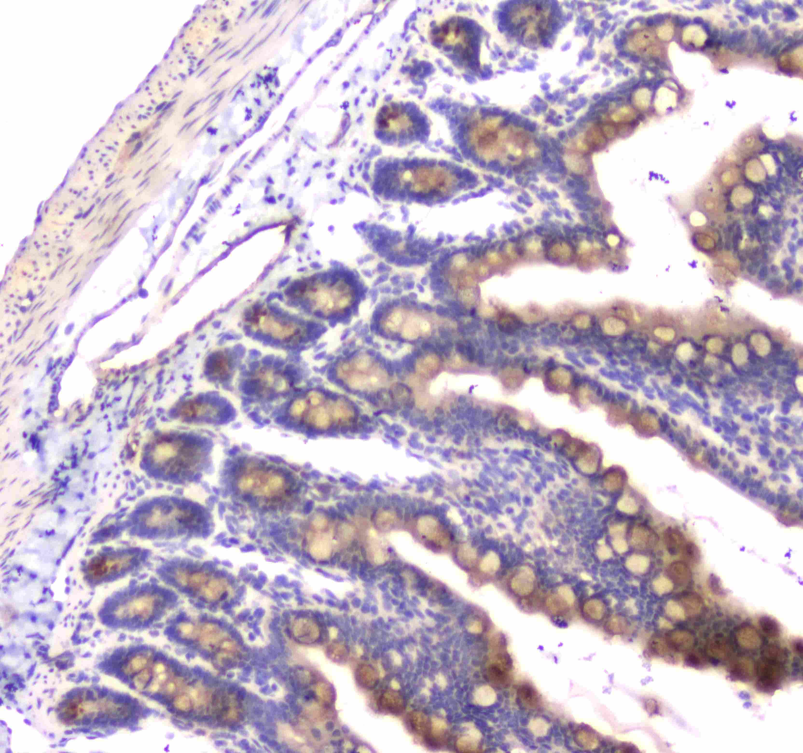 Polyclonal Rabbit anti-Human RAB27A / RAB27 Antibody (IHC, WB)