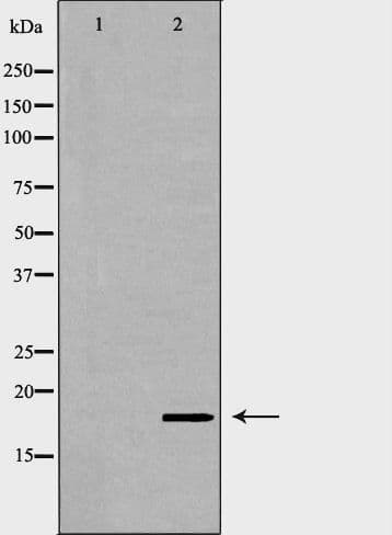 Polyclonal Rabbit anti-Human VAMP2 / VAMP-2 Antibody (aa2-30, IHC, IF, WB)