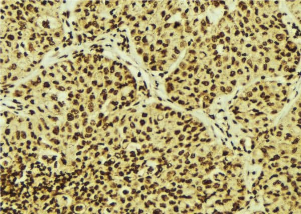 Polyclonal Rabbit anti-Human EFTUD2 Antibody (IHC, IF, WB)