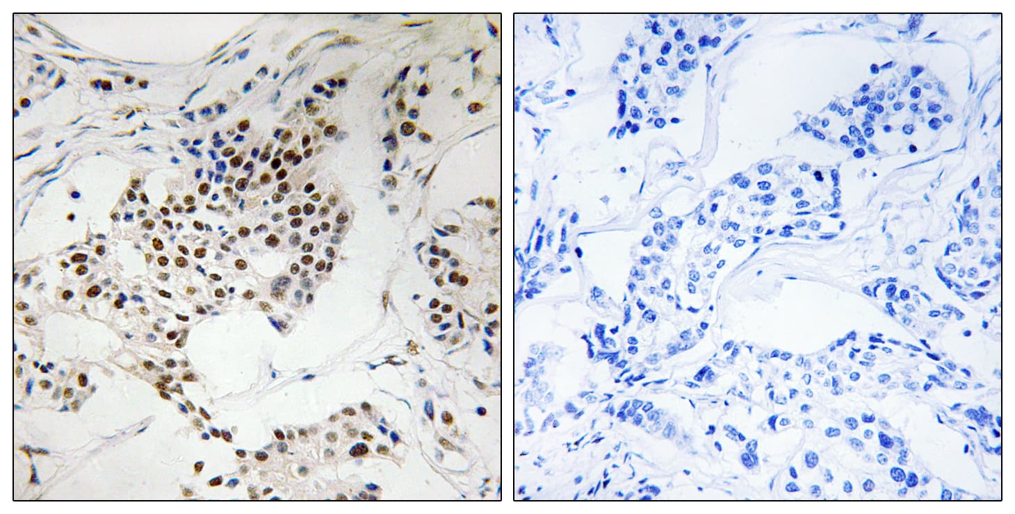 Polyclonal Rabbit anti-Human SGOL2 Antibody (aa681-730, IHC)