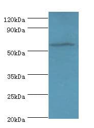 Polyclonal Rabbit anti-Human AMY1A / Salivary Amylase Antibody (aa16-200, WB)