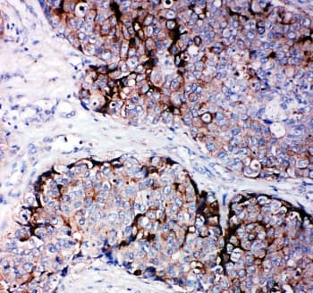 TIMP2 Antibody (aa205-220)