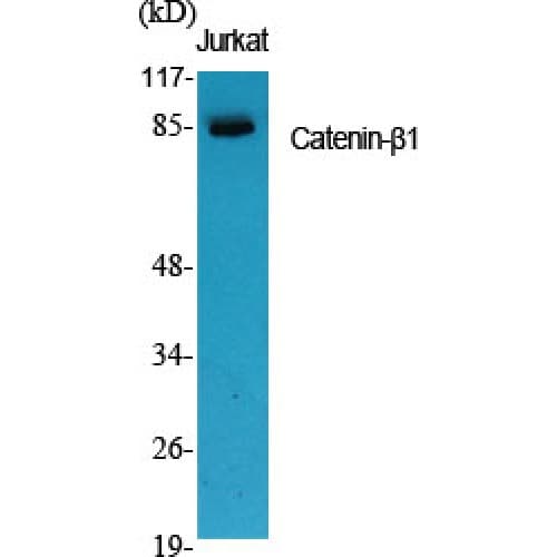 CTNNB1 / Beta Catenin Antibody (600-680 aa, C-terminal)