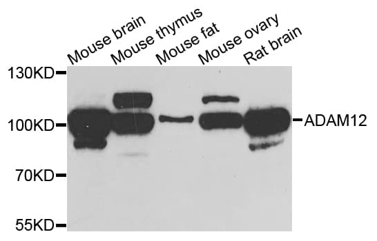 IHC-plus™ Polyclonal Rabbit anti-Human ADAM12 Antibody (IHC, WB)