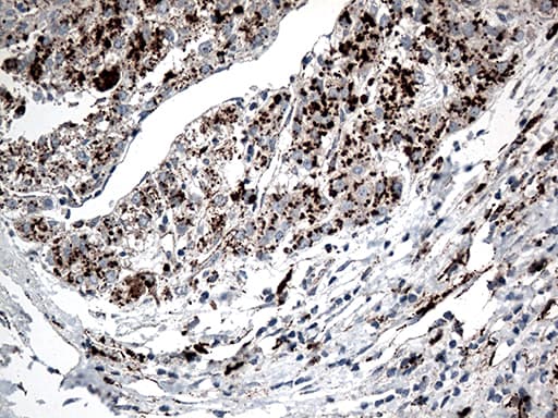 CTSL / Cathepsin L Antibody (aa114-333, clone OTI5C8)