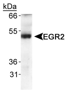 EGR2 Antibody (aa200-300)