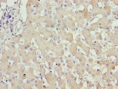 ZNF643 Antibody