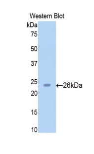 SIRT4 / Sirtuin 4 Antibody (aa60-255)