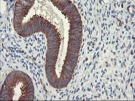 PFKP Antibody (clone OTI3H8)