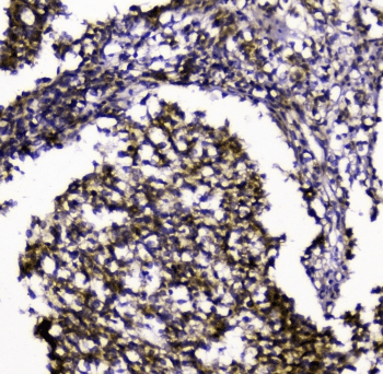 Polyclonal Rabbit anti-Human SIRT4 / Sirtuin 4 Antibody (IHC, WB)