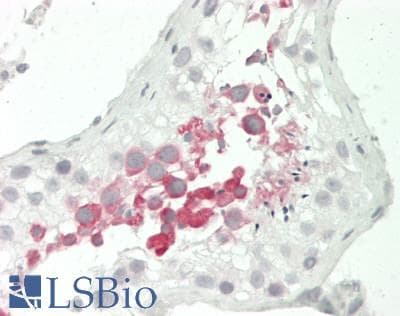 IHC-plus™ Polyclonal Rabbit anti-Human SLC6A1 / GAT-1 Antibody (Internal, IHC, WB)