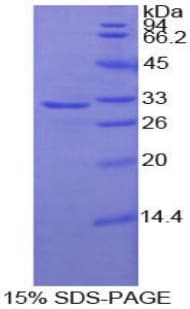 Human CNTN4 Protein (Recombinant His-T7)