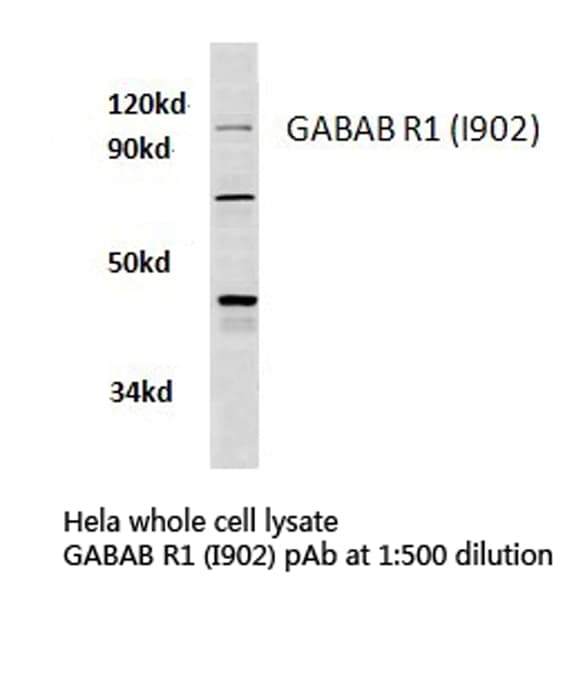Polyclonal Rabbit anti-Human GABBR1 / GABA B Receptor 1 Antibody (Ile902, IHC, WB)