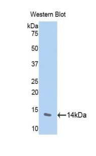 FGF23 Antibody (aa24-126)