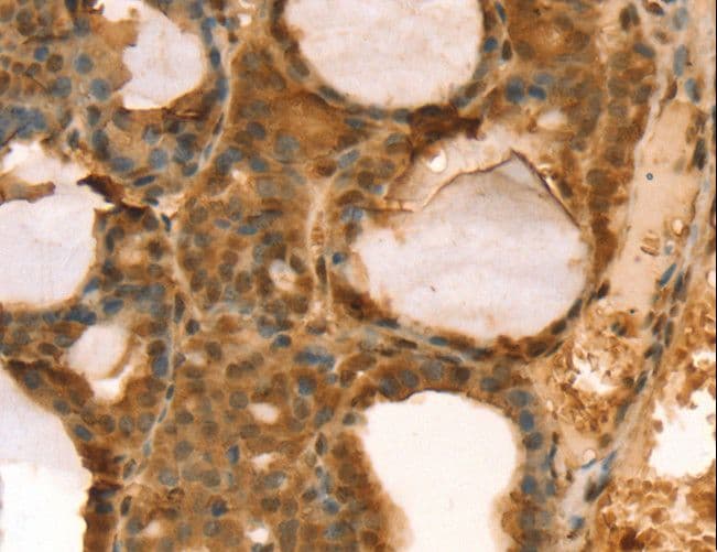 TAF11 Antibody
