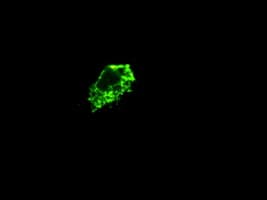 Monoclonal Mouse anti-Human Prominin 2 / PROM2 Antibody (clone OTI14D1, IHC, IF, WB)