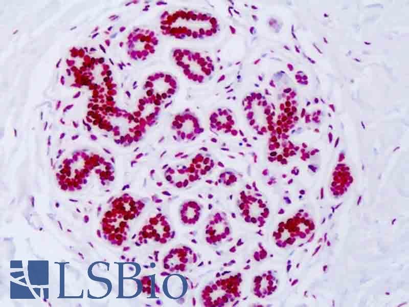 IHC-plus™ Histone H3 Antibody (Acetyl-Lys18)