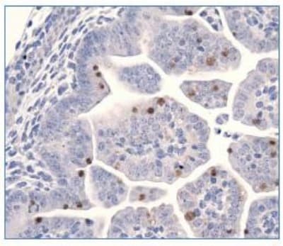 LIN28A / LIN28 Antibody