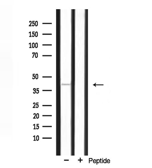 Polyclonal Rabbit anti-Human EKLF / KLF1 Antibody (IF, WB)