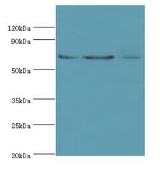 Polyclonal Rabbit anti-Human ACAD9 Antibody (aa1-270, IHC, WB)