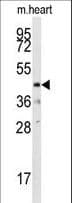 DUSP10 / MKP5 Antibody (aa1-30)