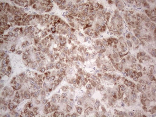 PD-L2 / PDCD1LG2 / CD273 Antibody (clone OTI12C7)