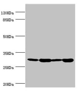 Polyclonal Rabbit anti-Human BAP29 / BCAP29 Antibody (IHC, WB)