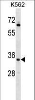 RAD1 Antibody (aa118-146)
