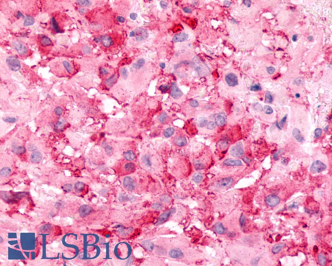 PathPlus™ ADGRB2 / BAI2 Antibody (N-Terminus)