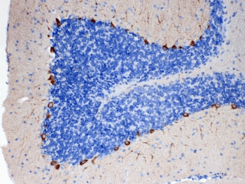 Polyclonal Rabbit anti-Human PA2G4 / EBP1 Antibody (IHC, WB)