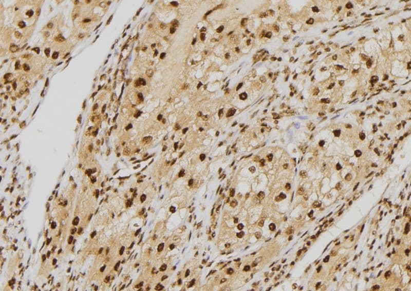 Polyclonal Rabbit anti-Human HEC1 / NDC80 Antibody (C-terminal, IHC, IF, WB)