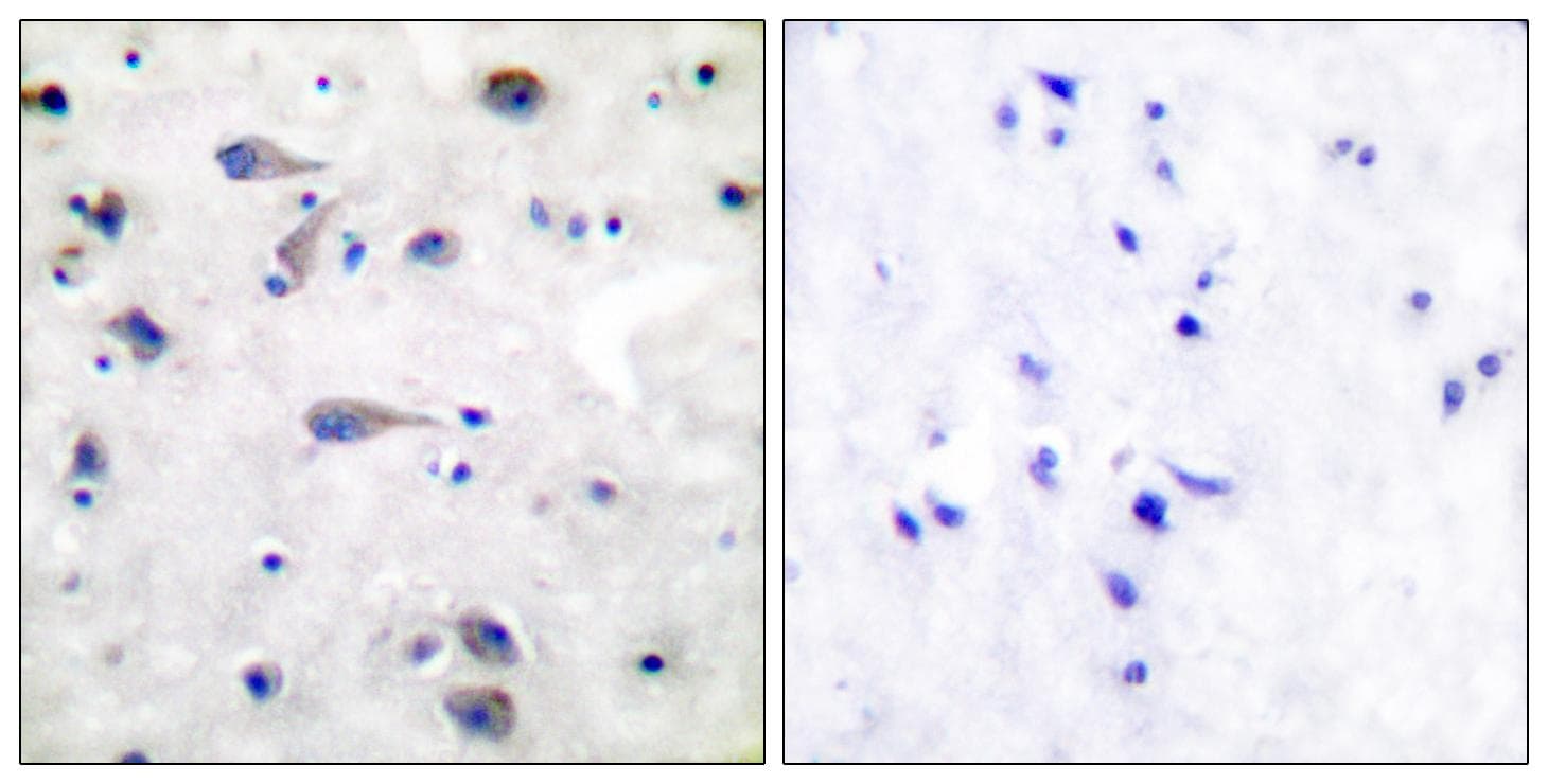OPRM1 / Mu Opioid Receptor Antibody (p375)