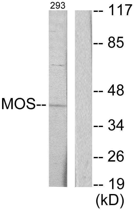 ADRB2 Antibody