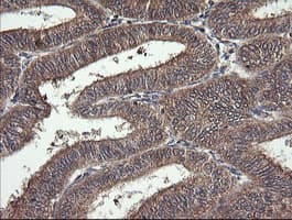 MAP2K1 / MKK1 / MEK1 Antibody (clone OTI2F12)