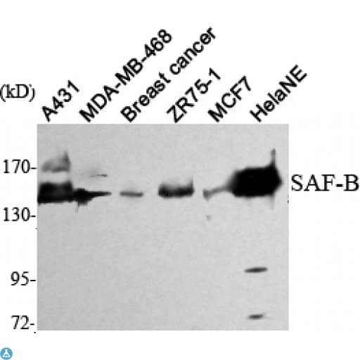 SAFB1 / SAFB Antibody