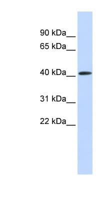 PARP11 Antibody (aa252-301)