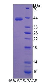Mouse Complement C4a Protein (Recombinant His-GST)