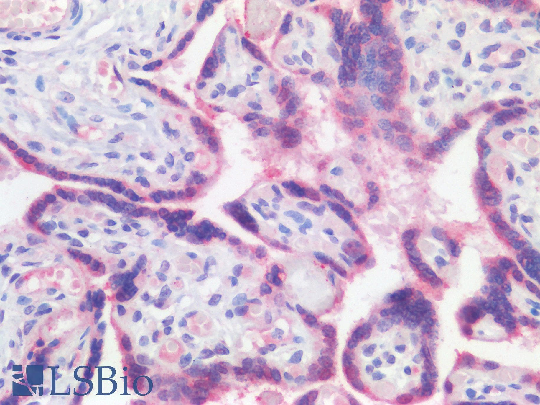 IHC-plus™ Polyclonal Rabbit anti-Human ATG16L1 / ATG16L Antibody (IHC, IF, WB)